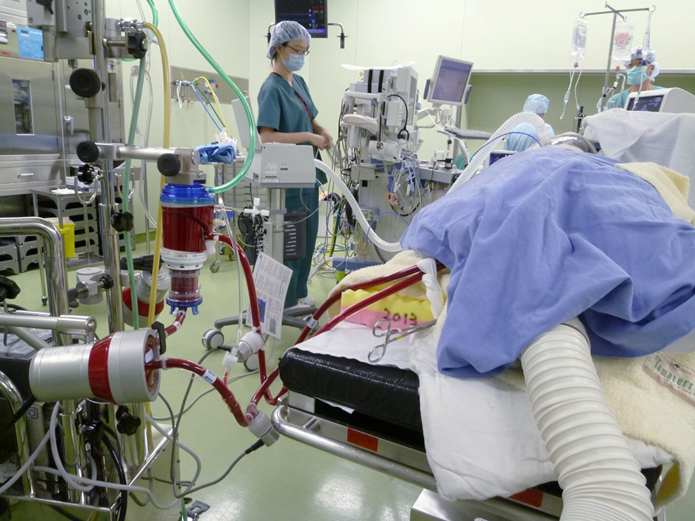 A patient undergoing ECMO. 